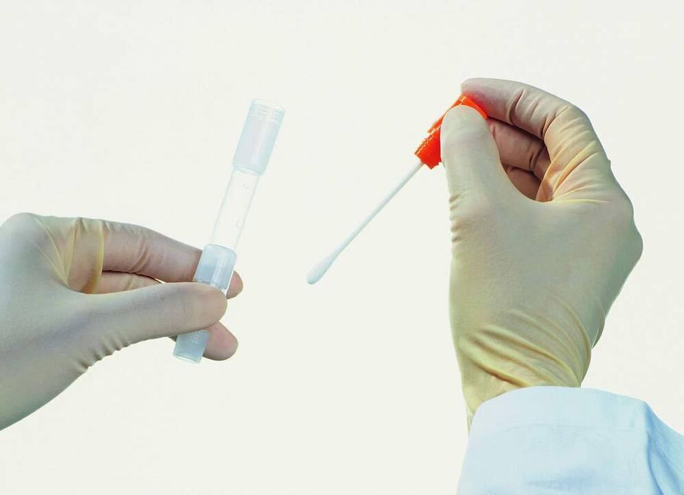 Collection of analysis to detect chronic prostatitis
